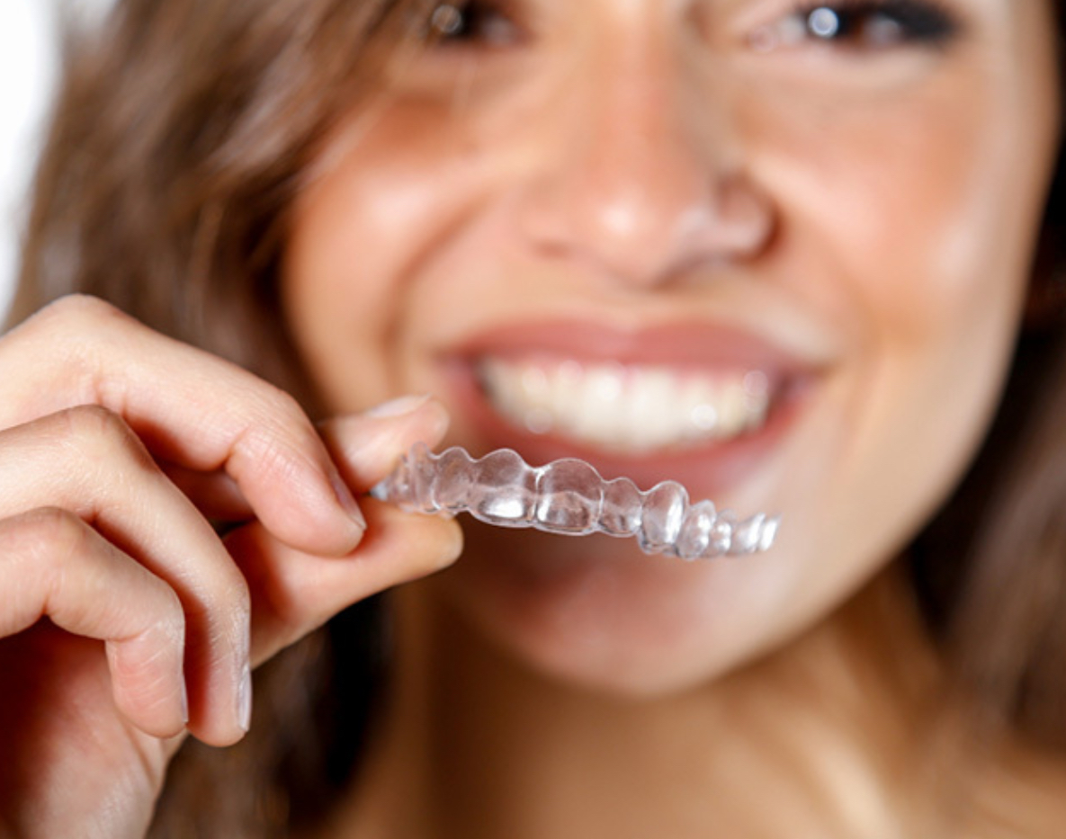 Dental Braces