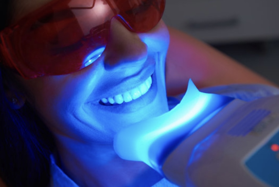 Teeth Whitening