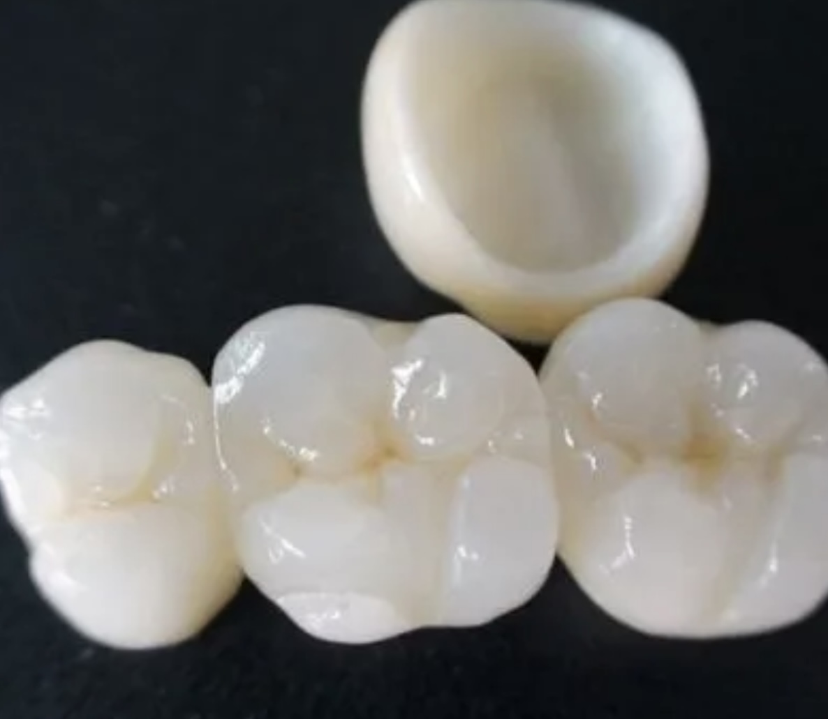 Hollywood Smile (Zirconia Crowns & Bridges) Image